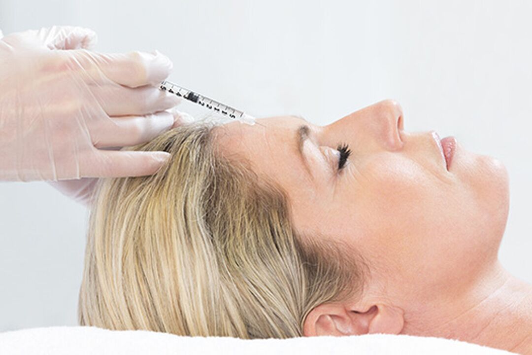 Плазмолифтинг е метод за инјектирање за подмладување на кожата на лицето